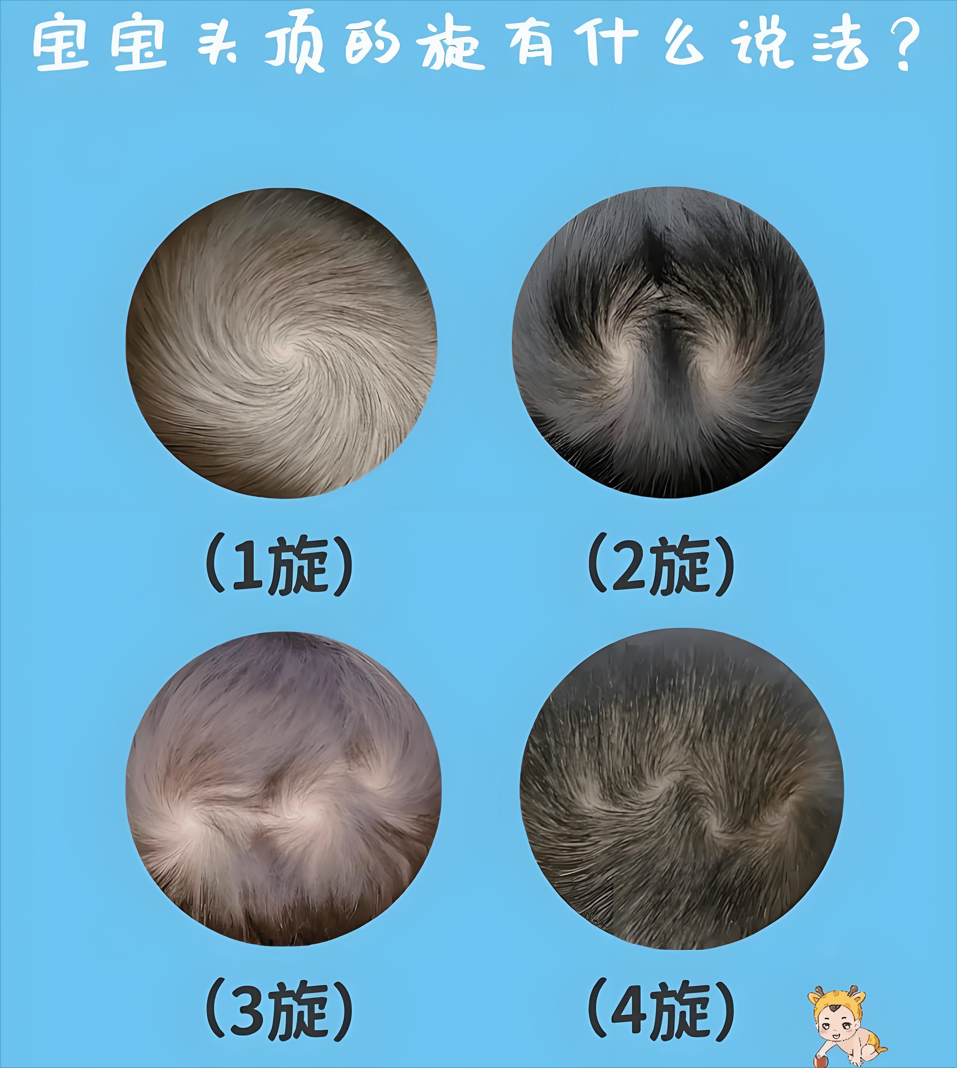 头顶有"2个旋"的孩子,真的更聪明,脾气更倔吗?看完涨知识