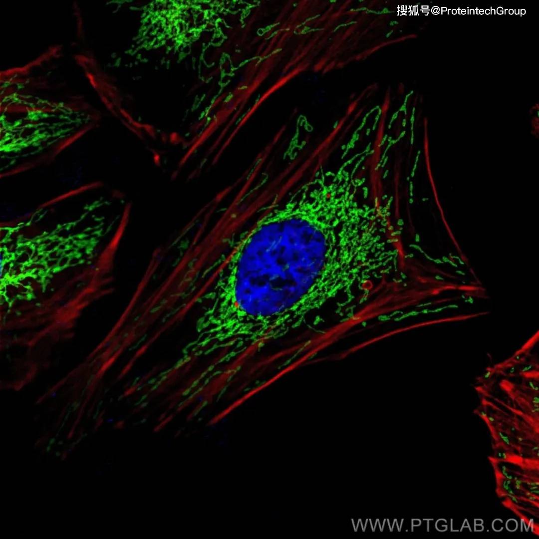 干货 | 多重免疫荧光染色常用方法全解析!附避坑指南