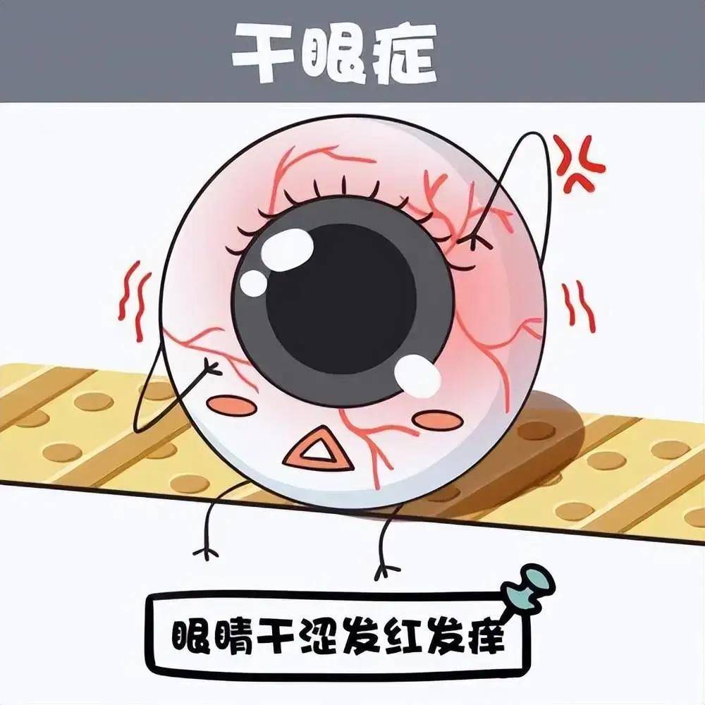 瞳立佳视力防控:干眼症不只是眼干!你的眼睛正在紧急求救!