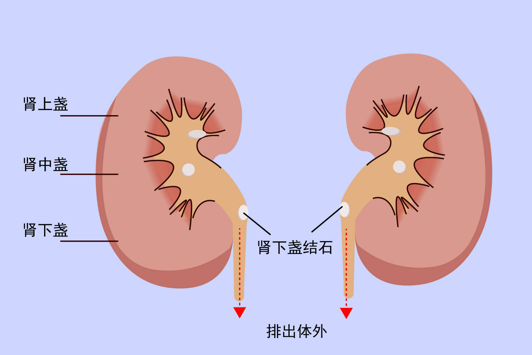 输尿管_尿液_草酸