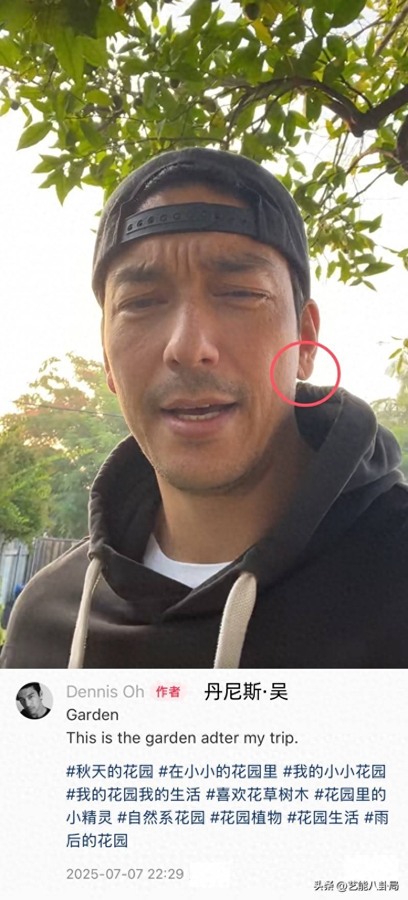 男神43岁罕晒视频,耳垂疑似"耳褶心征",网友:快去查心脏