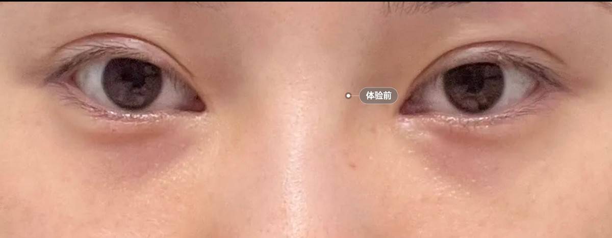 成都新丽美医疗美容:预付款退款拖延撕开“品质”承诺裂缝?(图9)