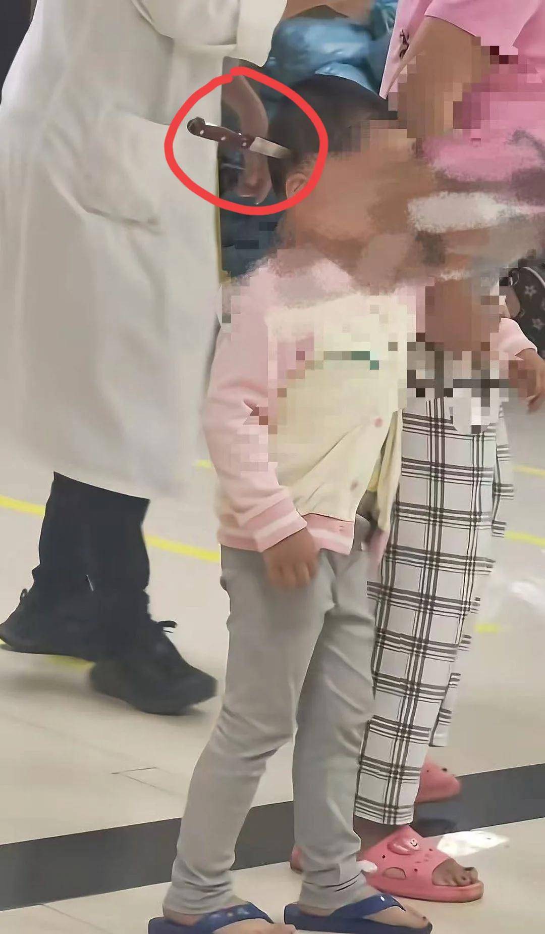 3岁女童头插水果刀淡定走进医院知情人透内幕网友必成大器