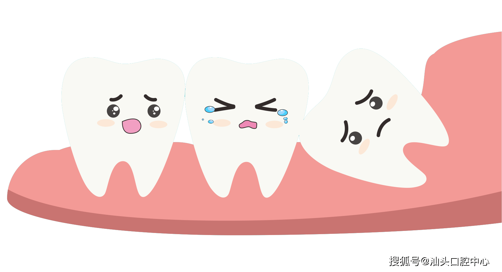 为什么不建议一次性拔除四颗智齿?