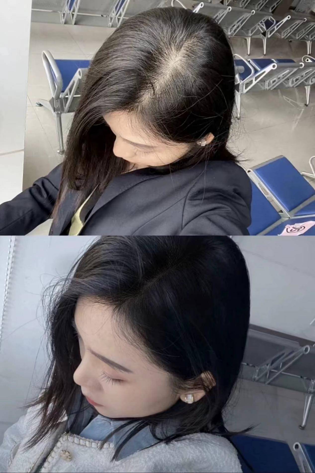 紫吕洗发水含有人参精华艾草牡丹皮提取物融合韩国草本配方与现代