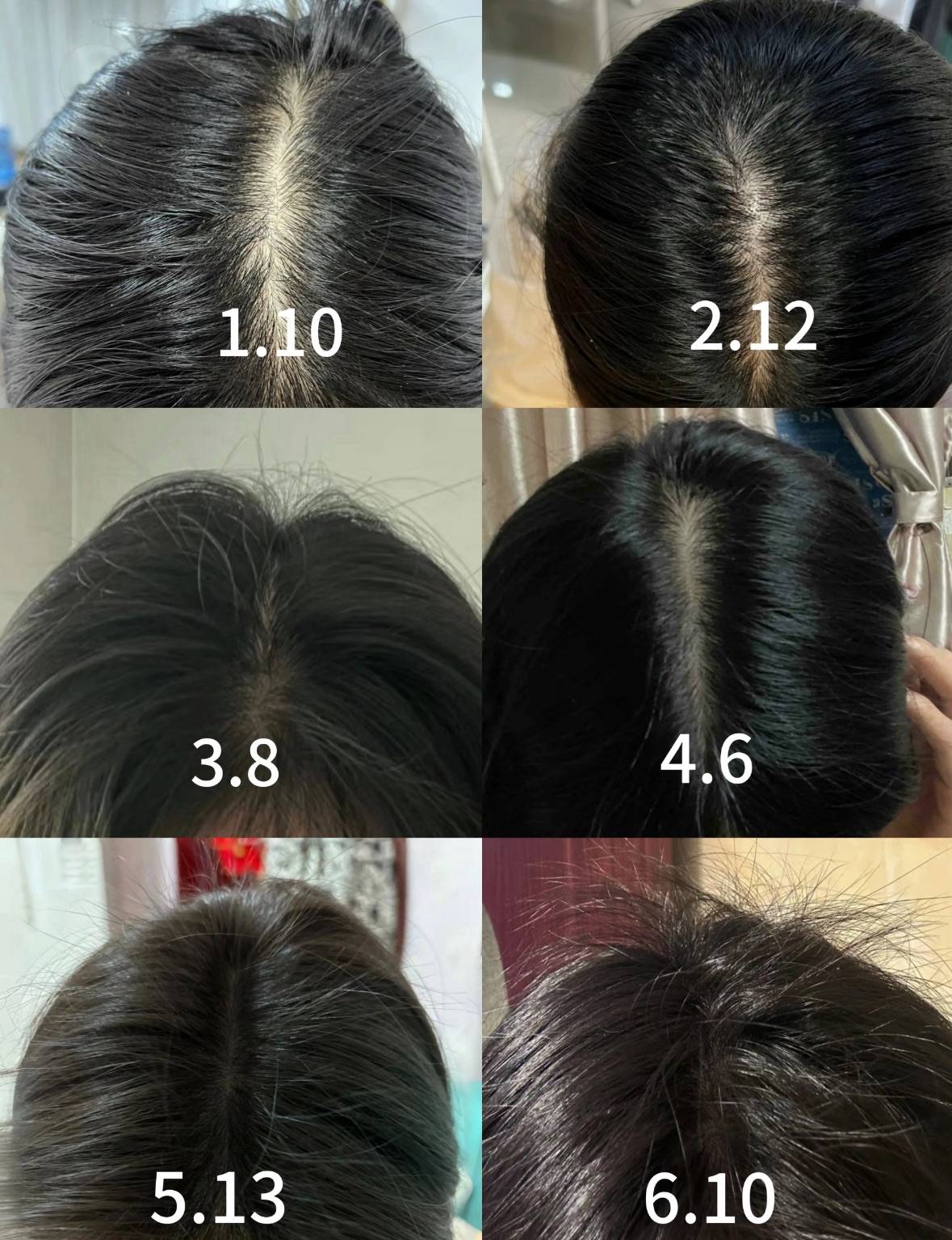 防脱生发最有效的十大产品排行榜排名第一的防脱育发产品挖宝小能手