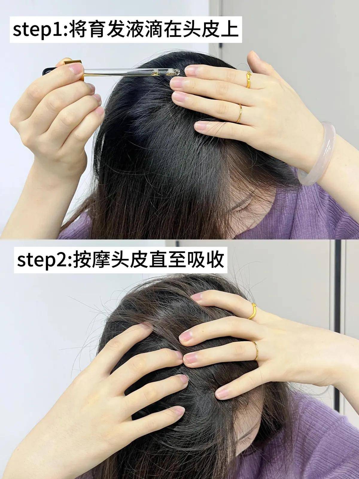 告别秃头 焦虑职场新人遇见长发村育妍堂的 生发惊喜