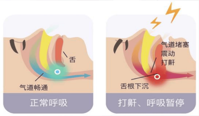 云触智能舒鼾枕M1:打鼾星人的“睡眠救星”来了!