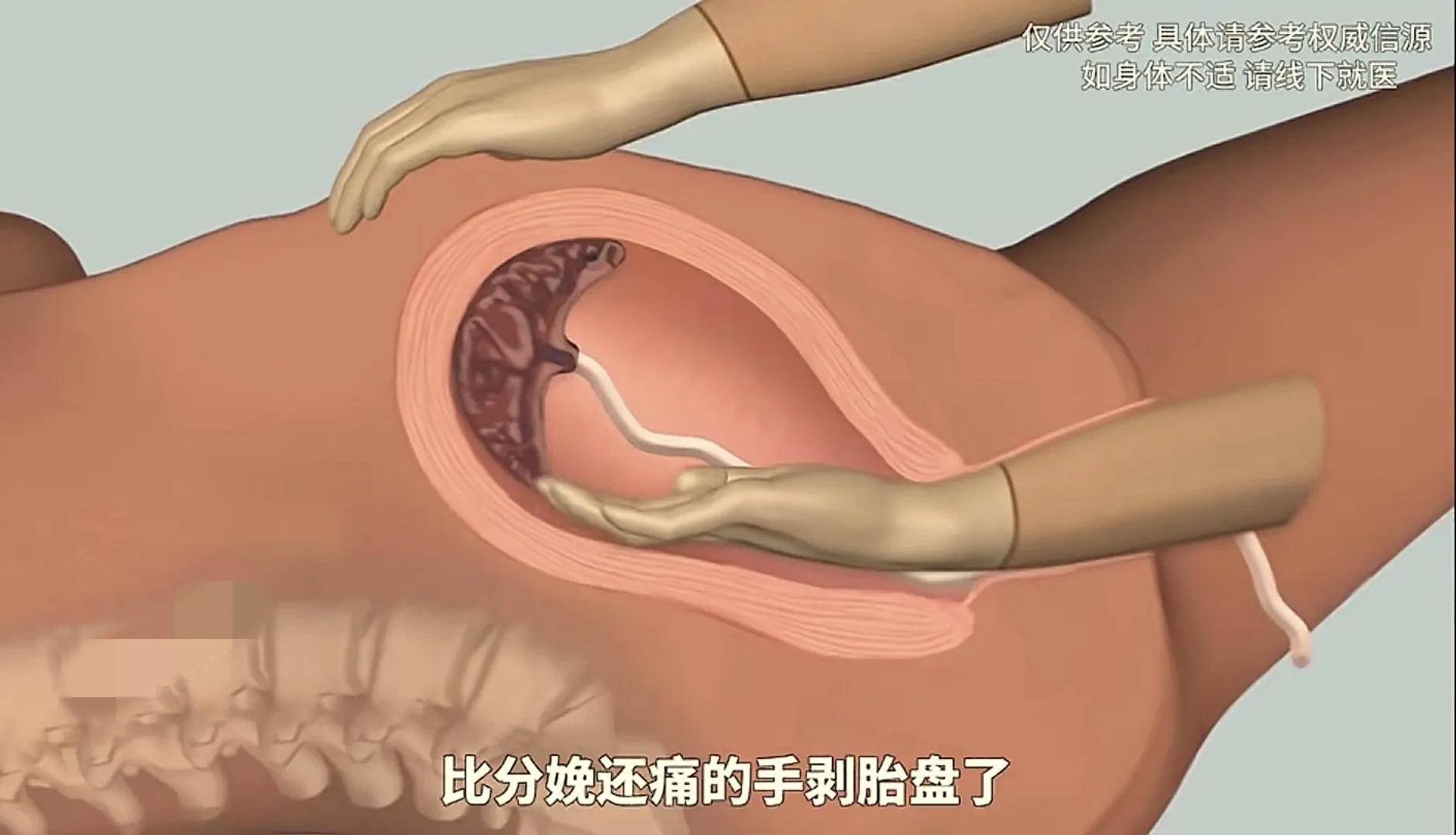 顺产全过程模拟,隔着屏幕都感觉疼,感恩伟大的妈妈