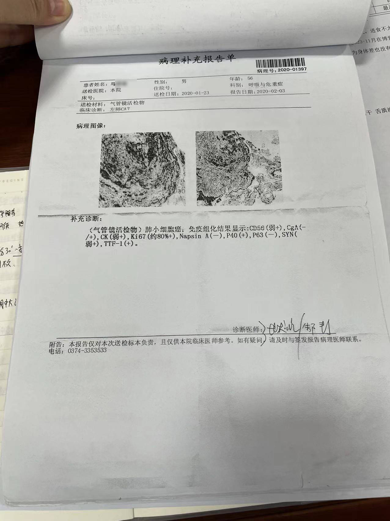 肺癌五年,肿瘤去哪了?一位老人"万步"抗癌路,医生都为他点赞