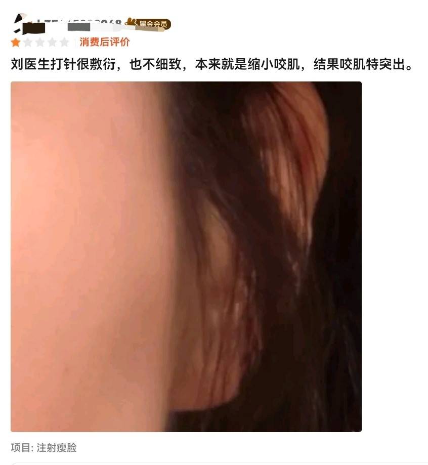 从肉毒素到双眼皮争议 河南整形美容医院如何突破信任困局?(图5)