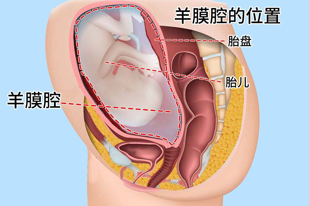 子宫里的水为什么要叫＂羊水＂, 而不是＂人水＂,或者其他的水？