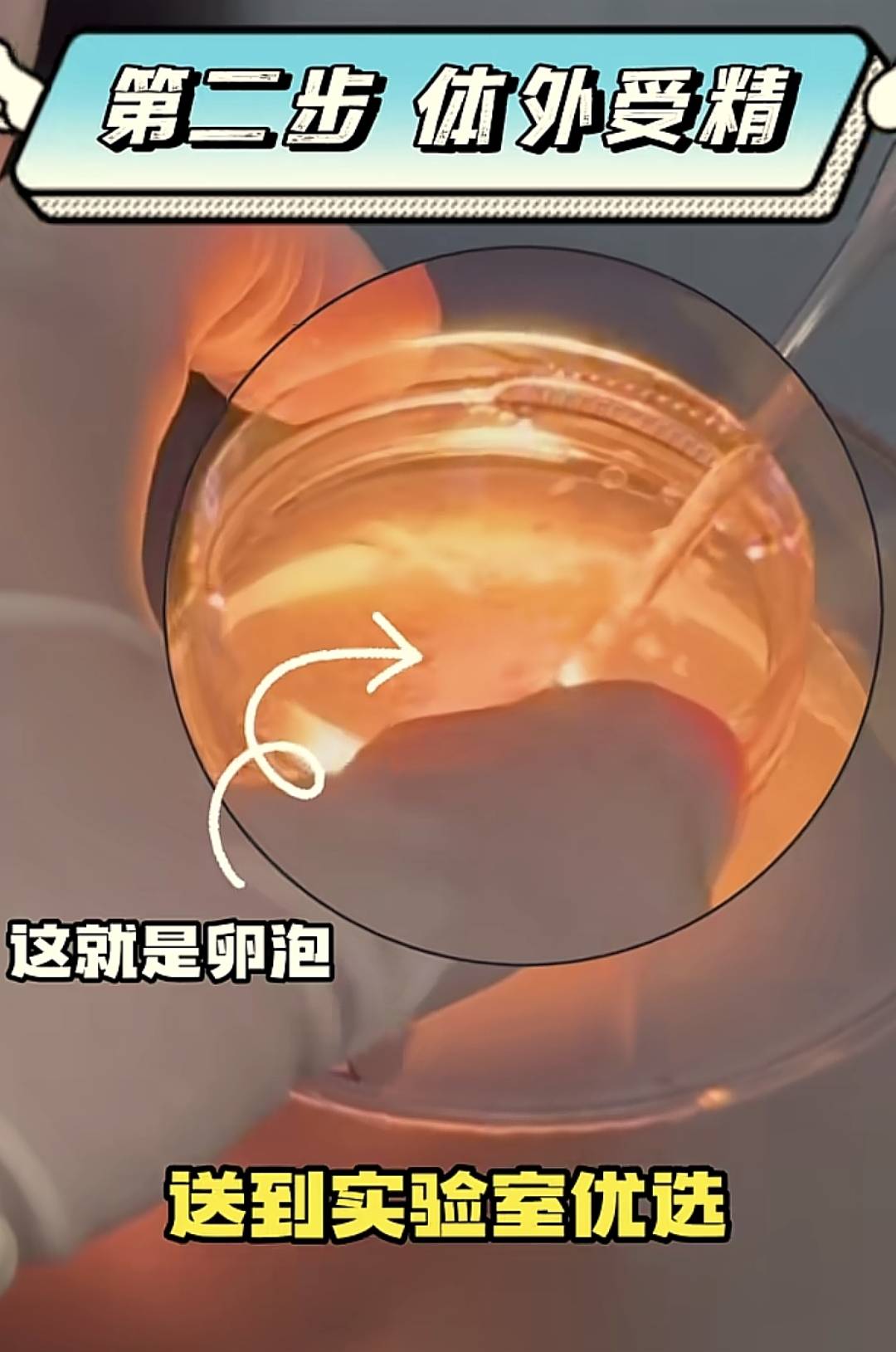 一组生殖科医生日常工作图揭露试管婴儿的奥秘：都是女的受罪