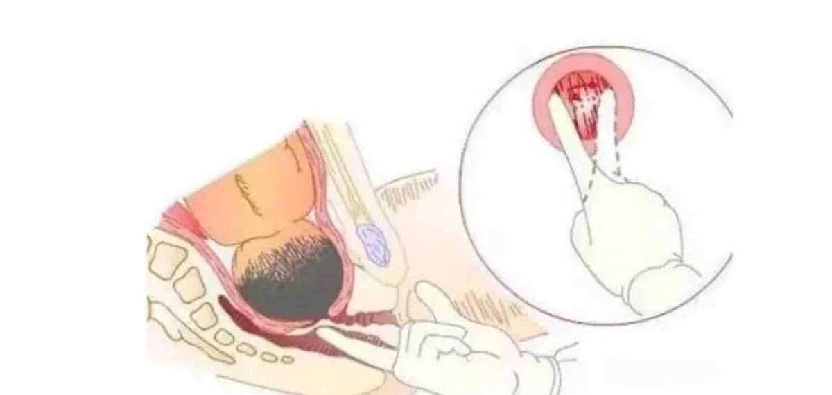 生孩子的这几个尴尬瞬间,你碰到过哪些呢？