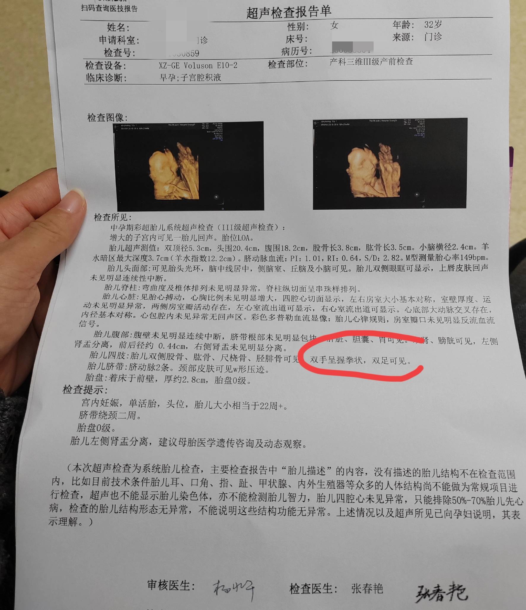 孕检一切正常却生下畸形儿怎么回事？医生说出原因：很无奈