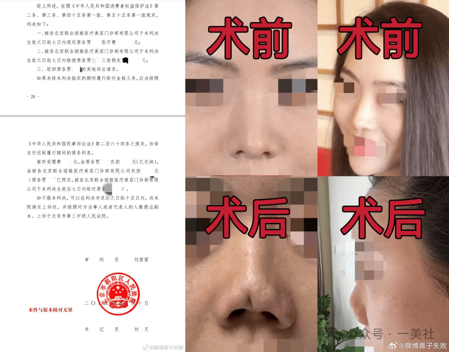 起底俊泰系医美乱象:违规聘用未备案医师 鼻整形失败致畸形(图11) 文章配图-3