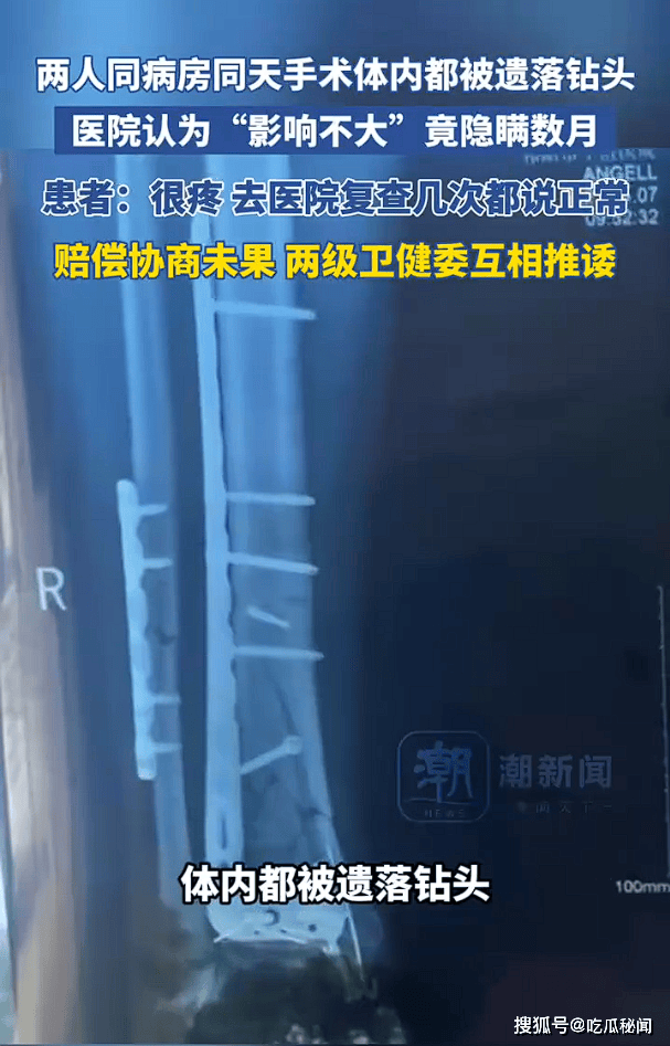 钻头遗落患者体内祁阳医院隐瞒数月 两人手术体内被遗落钻头(图2)