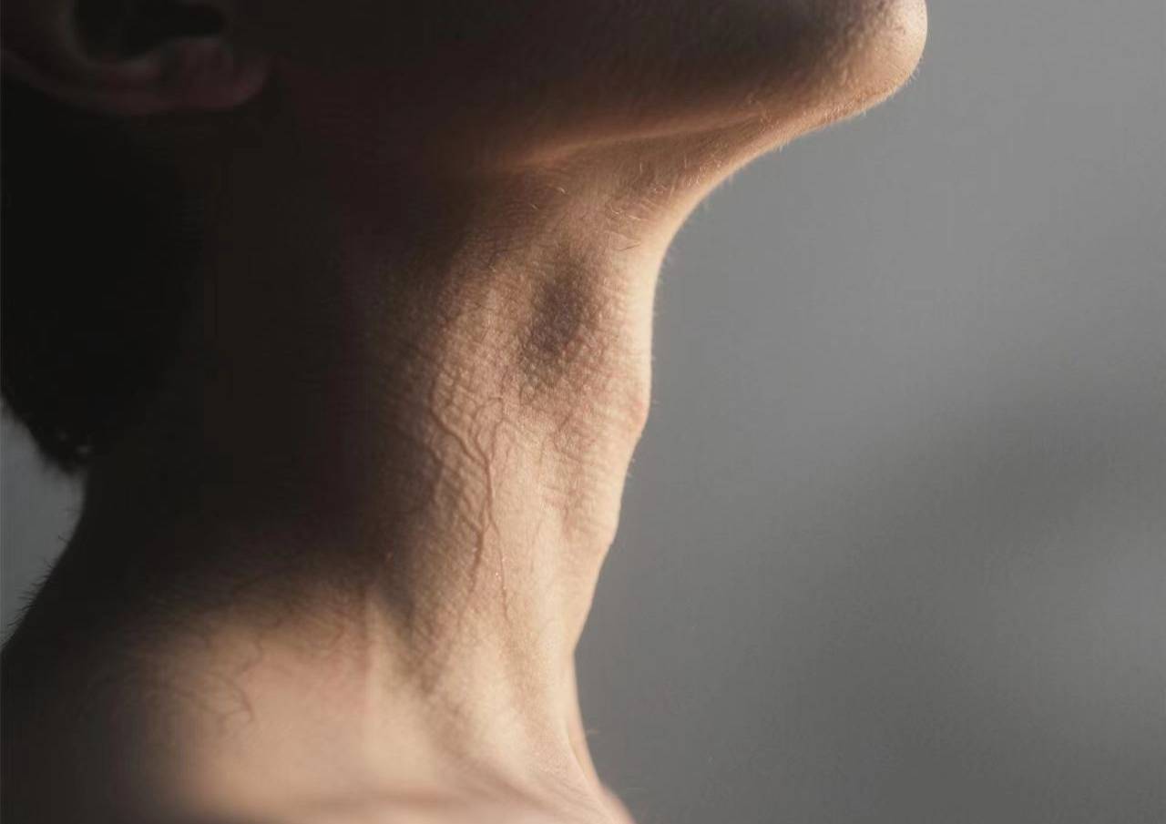 体检单上的甲状腺结节，藏着这些危险信号