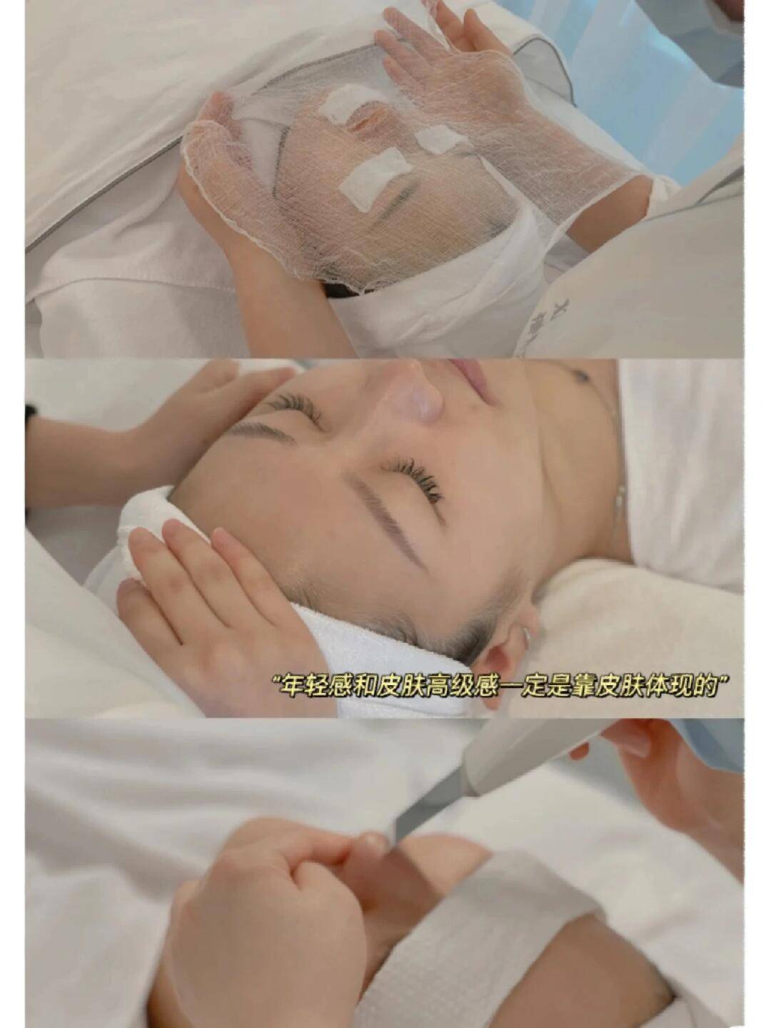 如果是黑色痘印那基本是因为你挤过痘痘皮肤受损后又没做好防晒