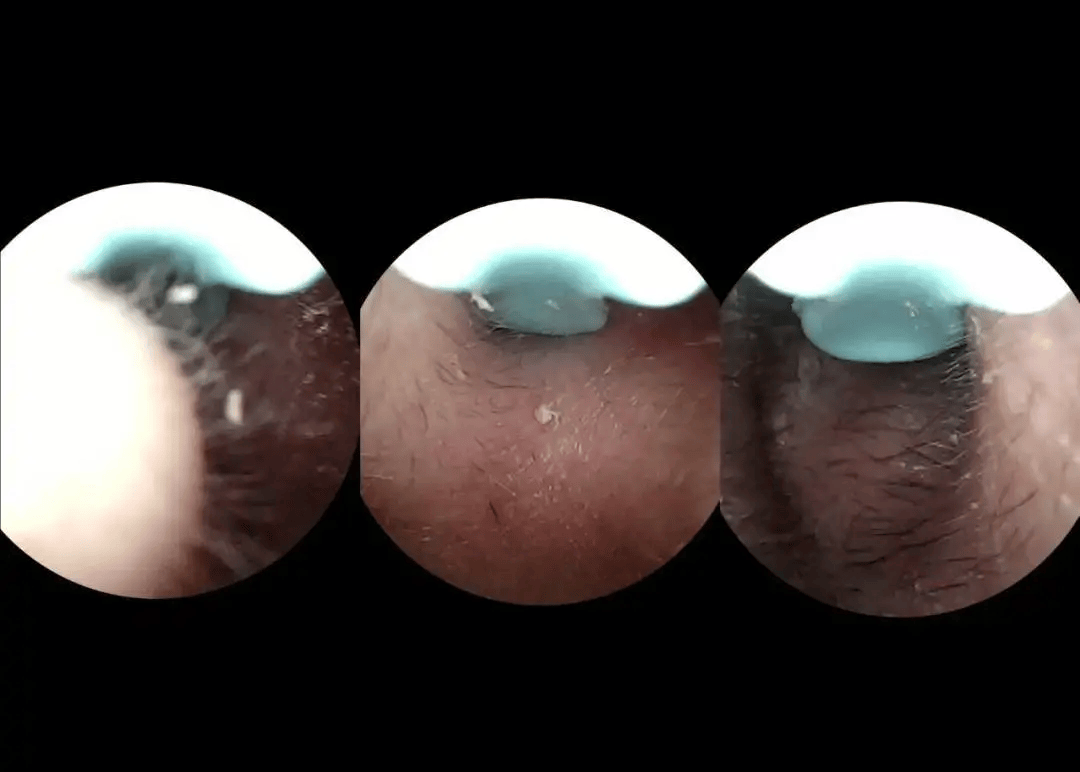 2026可视耳勺哪个牌子好？扒透了！清洁不伤耳的可视挖耳勺推荐