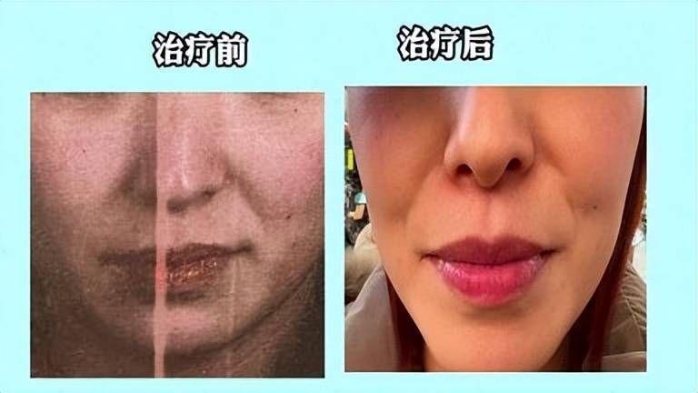 女子称6999超声刀没效果 西安高一生医疗美容被指病历代签?(图2) get?code=NjE0MTg4ZmQ0OGRmY2NlYjg4ZWE1ZGYzZGJkZDNmMWIsMTc3Mzg4NTQ4NzI4MA==