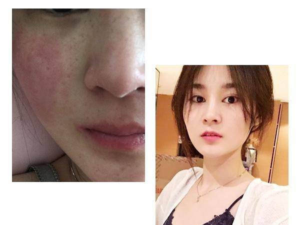 温和有效抗老产品推荐_:敏感肌抗老面霜_白松露奢华面霜