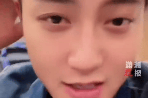 黄子韬直播辟谣秃顶传闻！自曝减肥过度致斑秃，涂姜生发反加重脱发