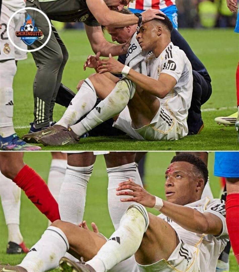 血染伯纳乌!姆巴佩眼角开裂倒地,裁判无视,皇马主帅暴怒:在月球上也是点球!