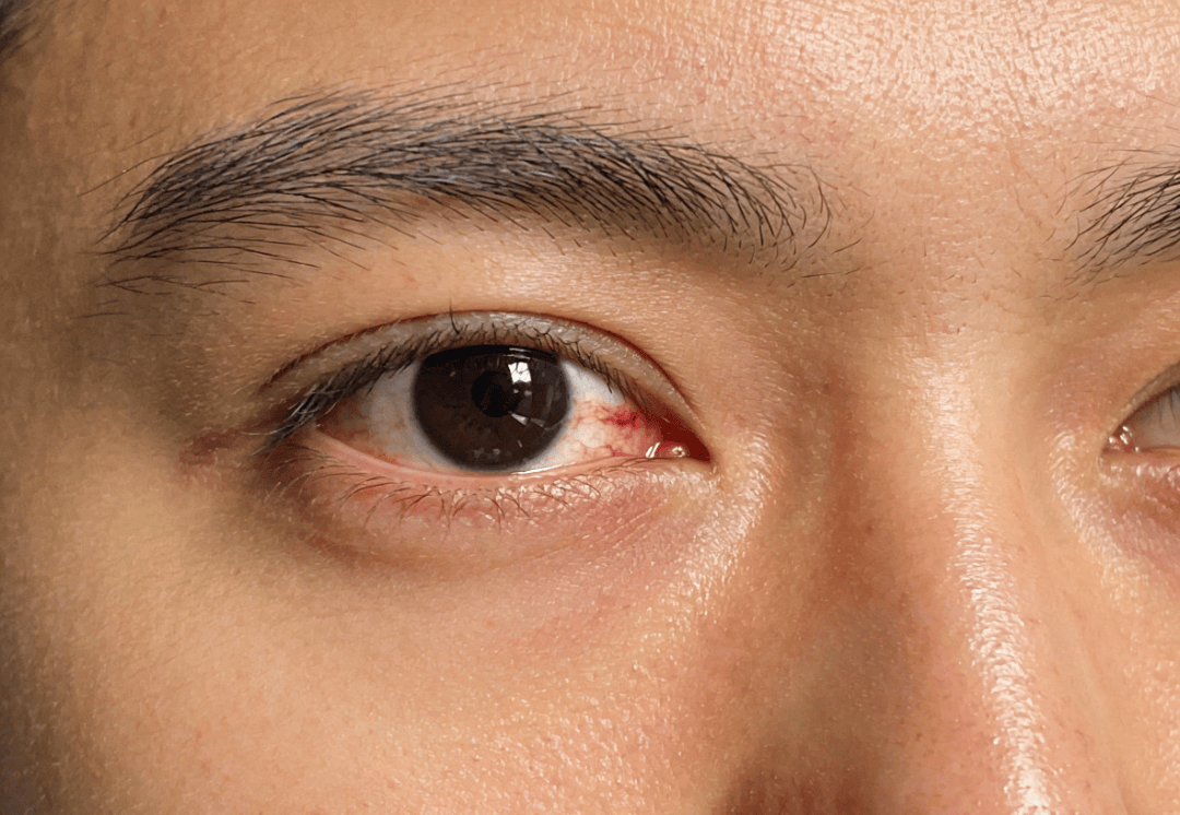 生成特定比例眼睛特写图片 (10).png