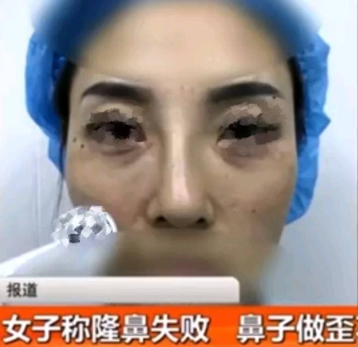 两年罚单加三年被执行 口碑饱受争议的西安允朵医美如何破局(图11) 文章配图-1