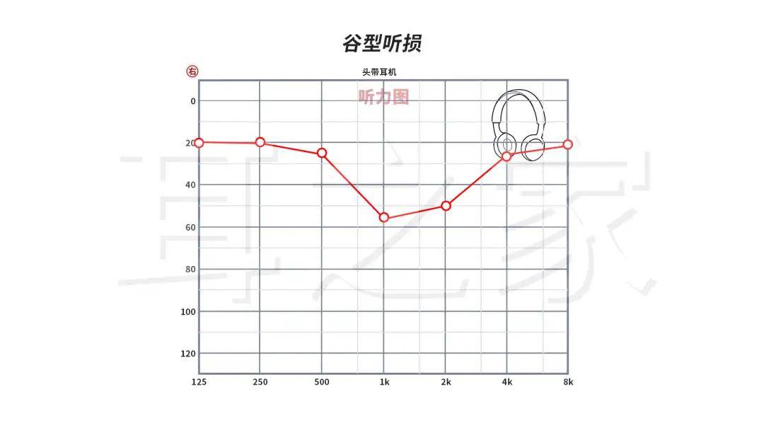 纯音听力图零基础入门：临床常见7种听力图类型快速识别指南（下）_言语_频段_干预
