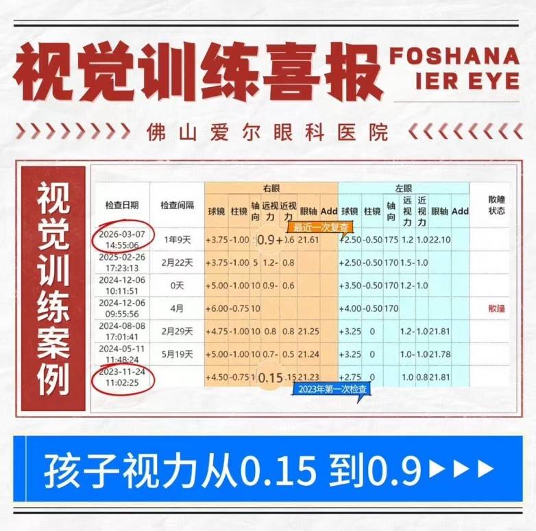 佛山爱尔李亮亮博士:用个性化视觉训练,帮孩子“练眼力”(图1) 佛山爱尔李亮亮博士:用个性化视觉训练,帮孩子“练眼力”(图1)