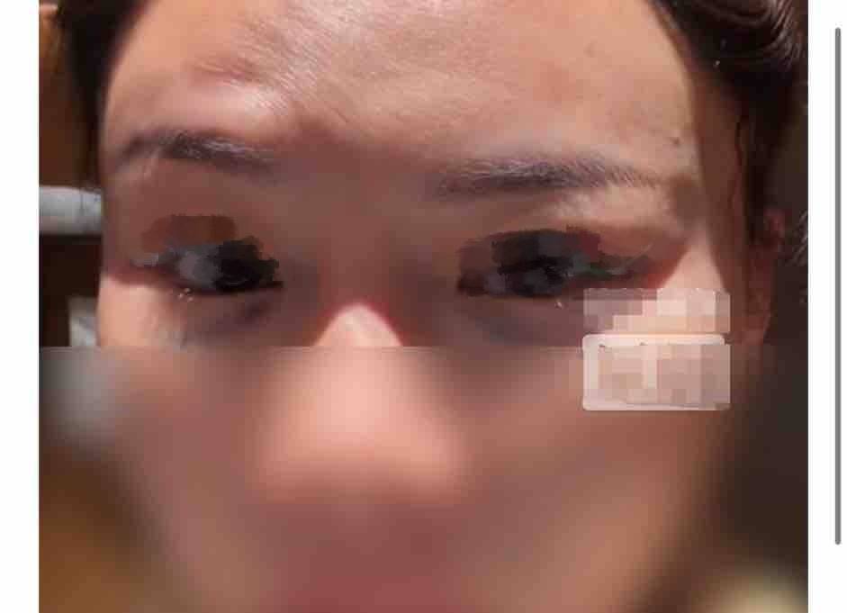 从双眼皮毁容到盗用肖像 上海颜净医美的瓜怎么越吃越多?(图10) 文章配图-2