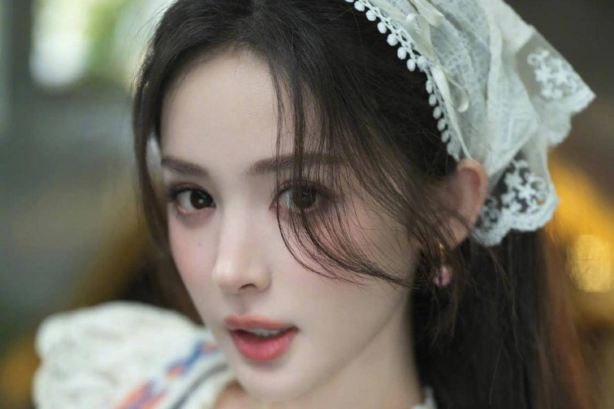 古力娜扎眼部恢复不佳,医生疑与童年旧疾有关,或需手术