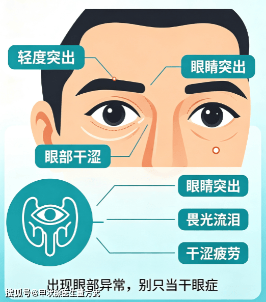 莫名突眼、眼干畏光、反复浮肿？别只当用眼累！多半是甲状腺在病变