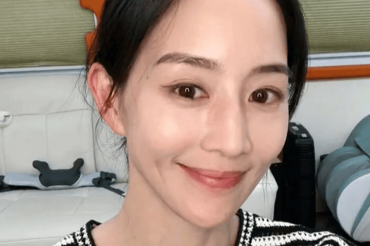 44岁张钧甯自曝冻卵手术完成，人生规划与健康管理并重