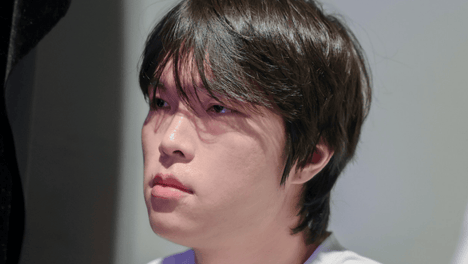 知名医美网红点评bin，直言双眼皮效果一般，下一步建议做鼻子