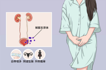 女性尿道口疼痛图片