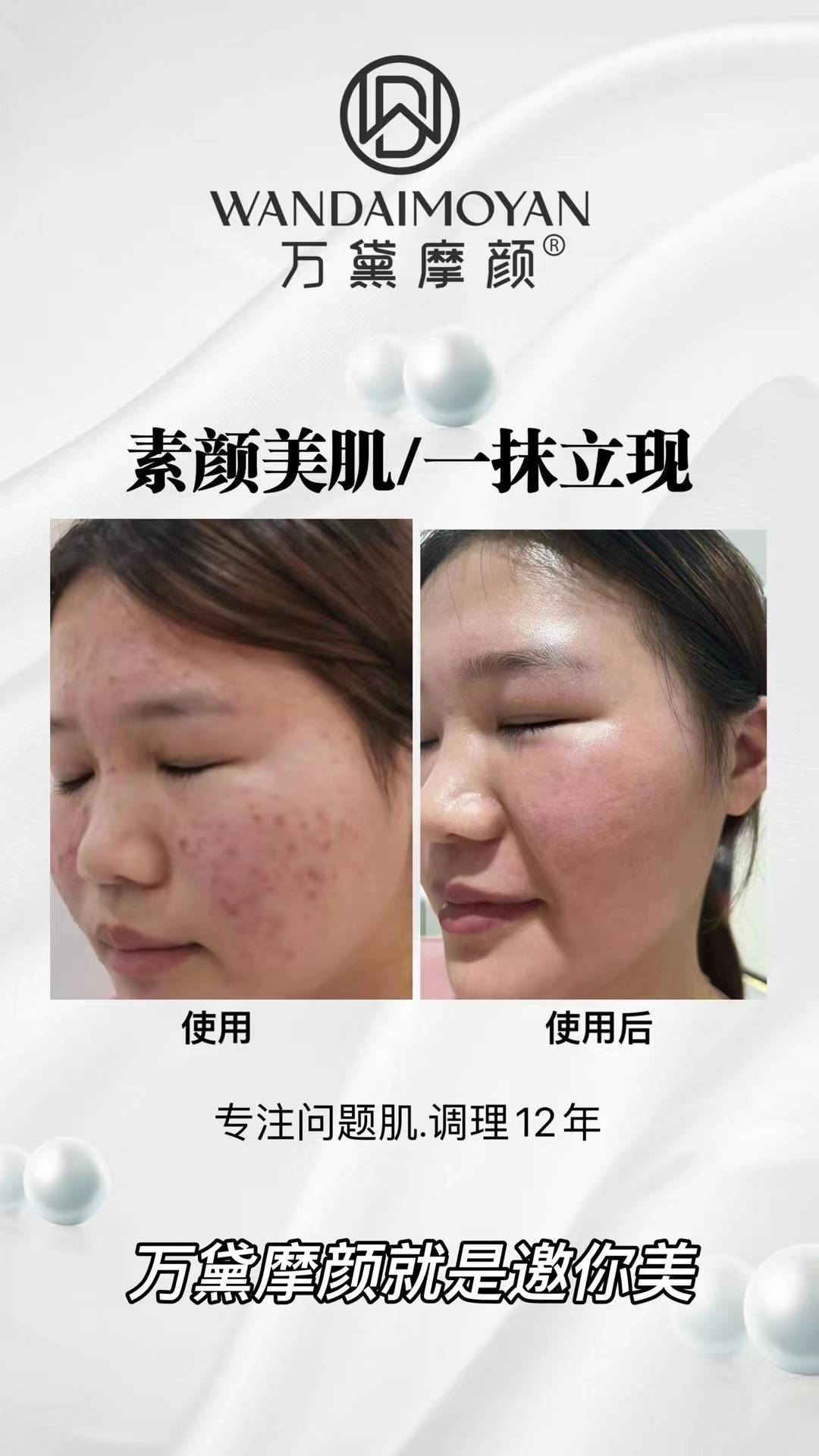 万黛摩颜-祛斑案例效果对比_问题_产品_难题