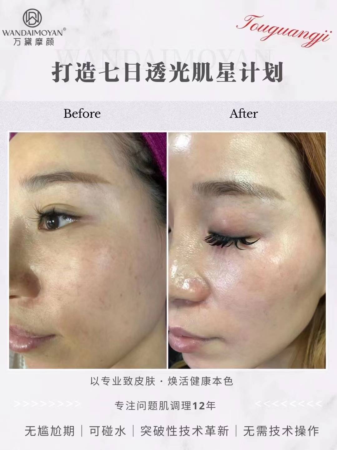 万黛摩颜-祛斑案例效果对比_问题_产品_研究