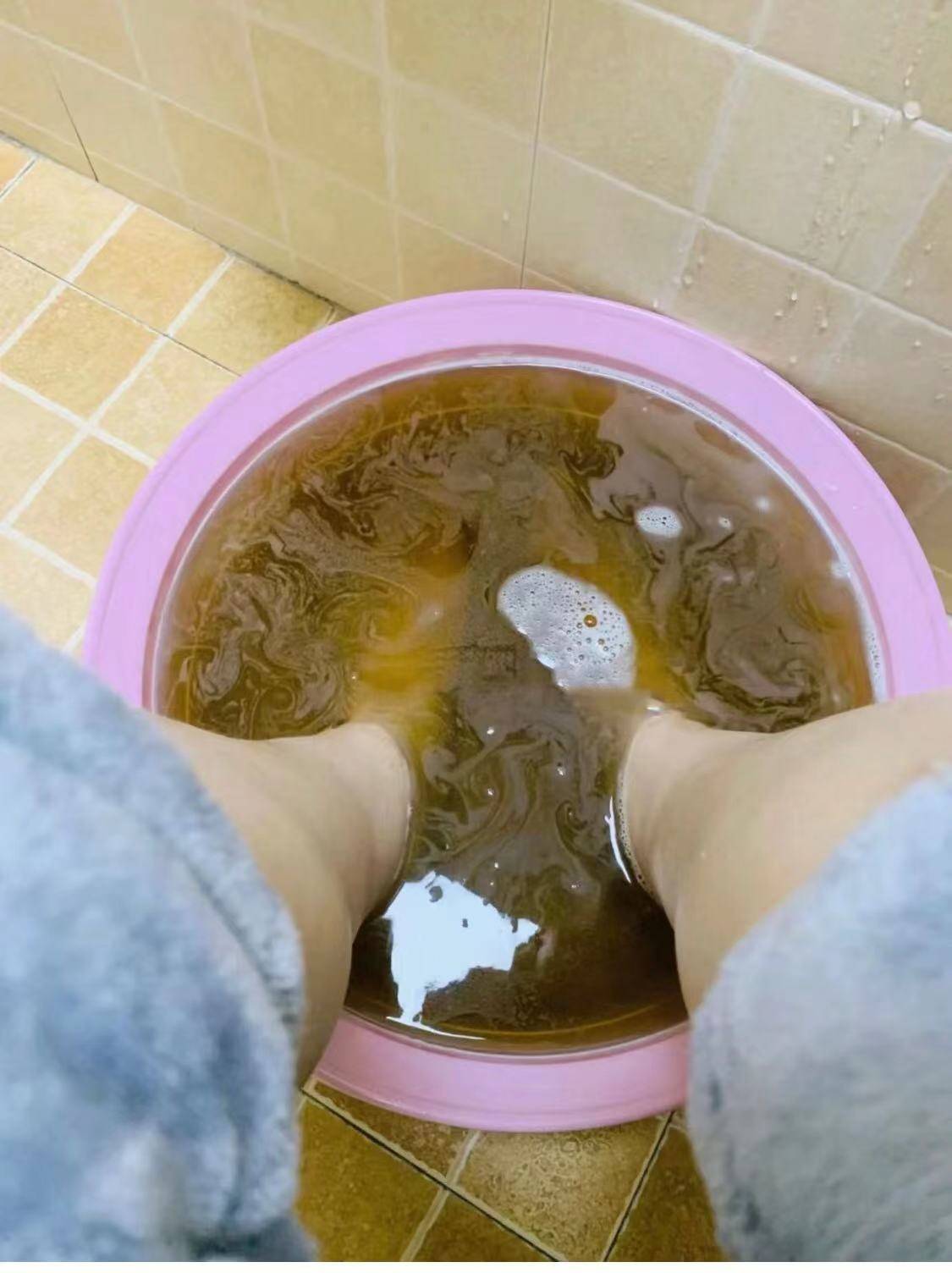 阻断真菌感染源头:避免与他人共用脚部用品,如鞋,擦脚布,泡脚盆和