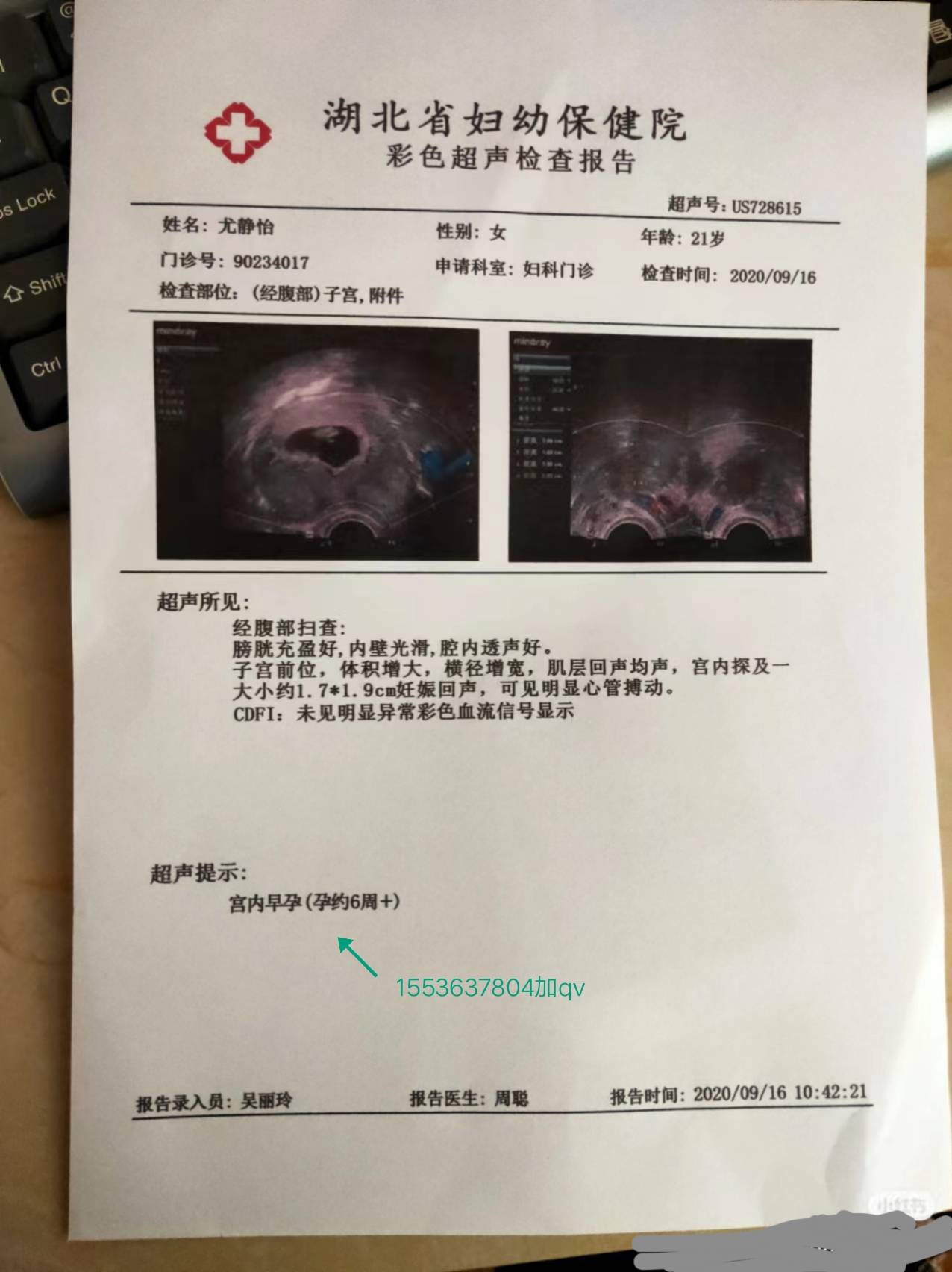 2024年怀孕后想在北京世纪坛医院建档需要准备哪些材料