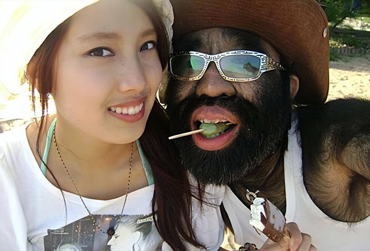 原创当年轰动一时的毛孩42岁娶90后娇妻生下一子未遗传长毛