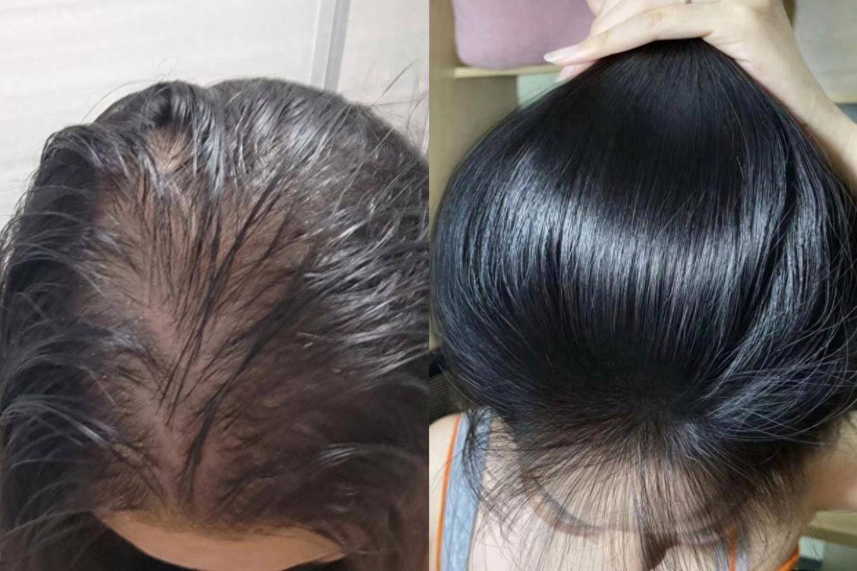 头皮_头发_方面