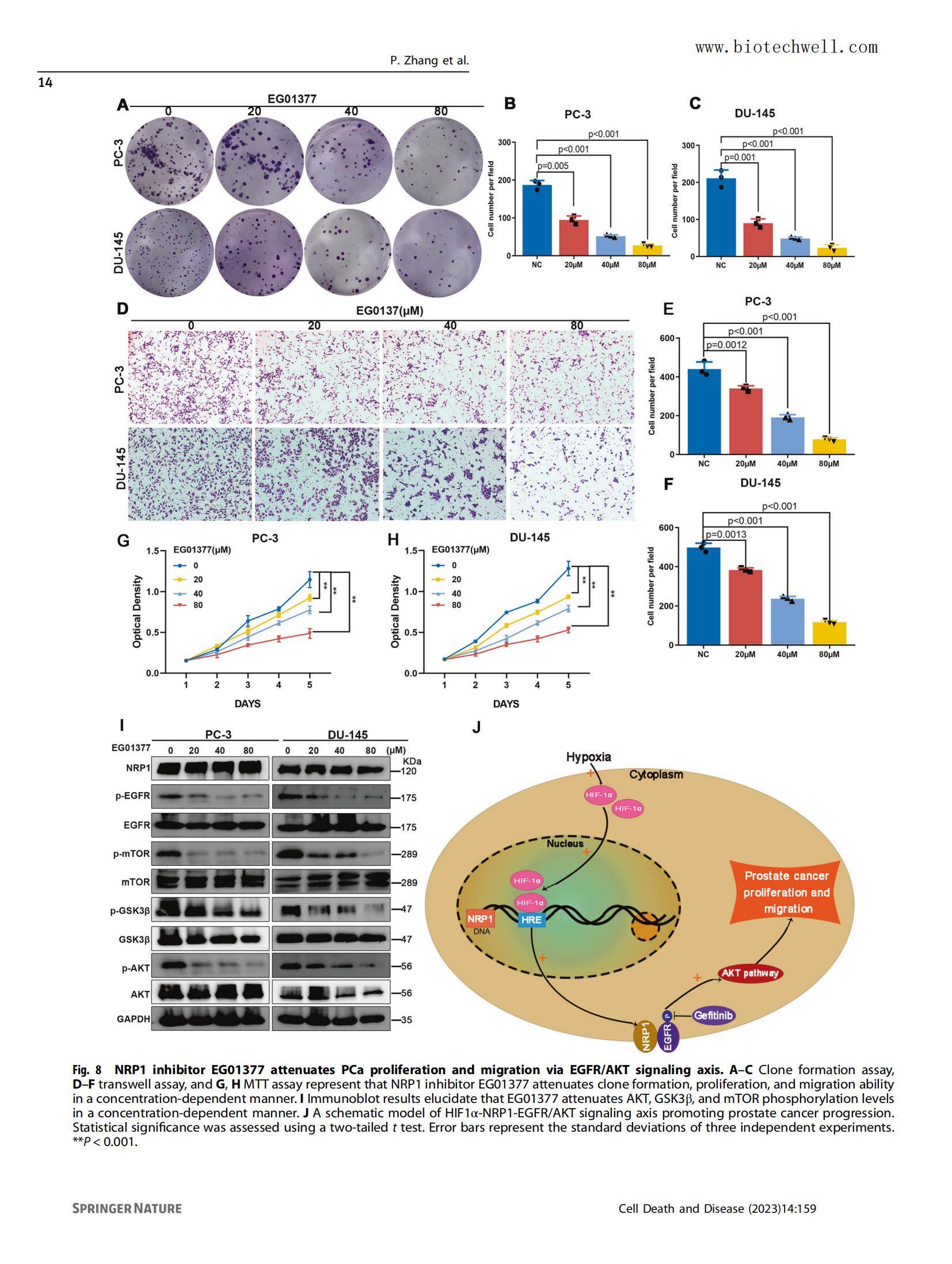 上海威奥前列腺癌组织芯片文献14
