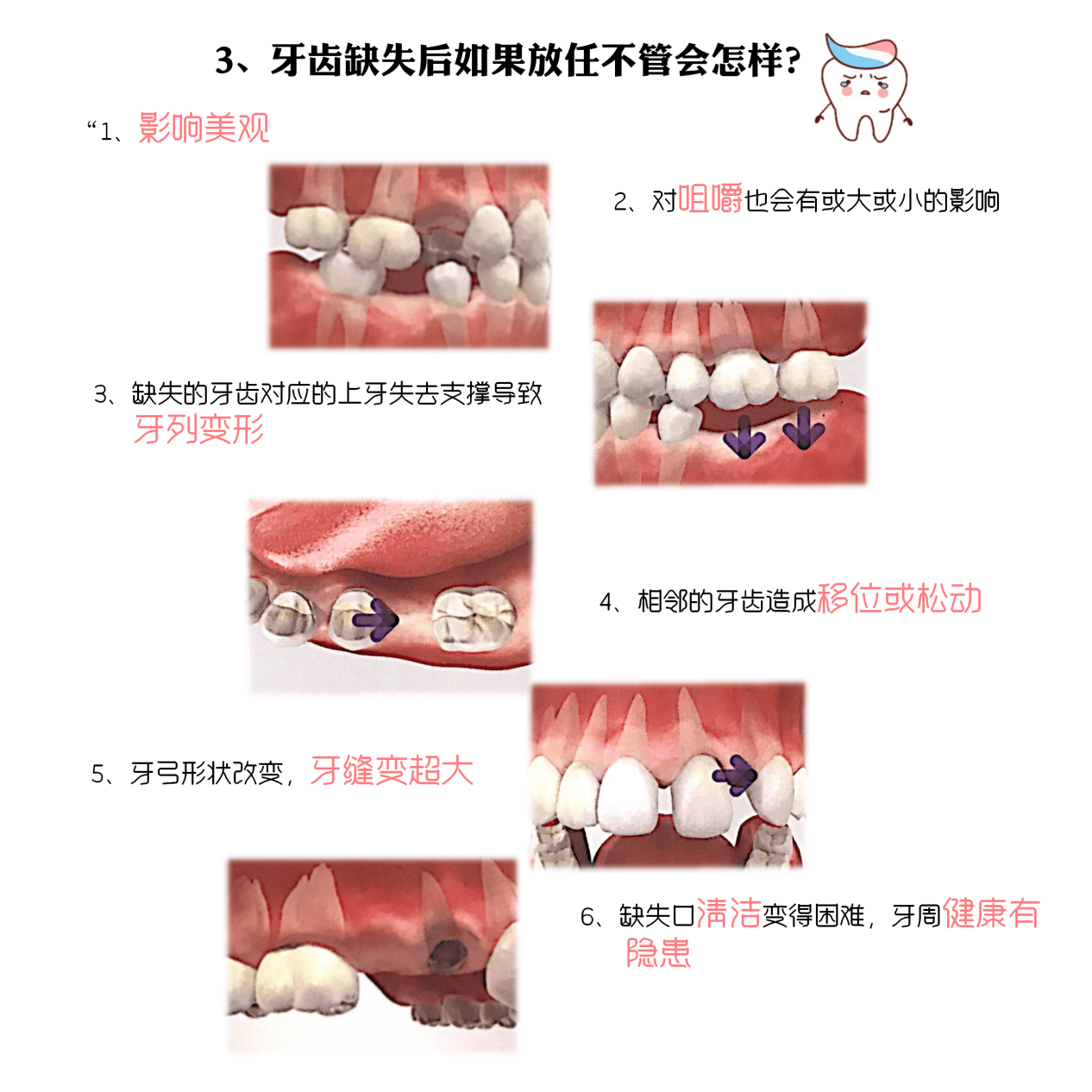 牙齿缺失了几年可以做种植牙吗?