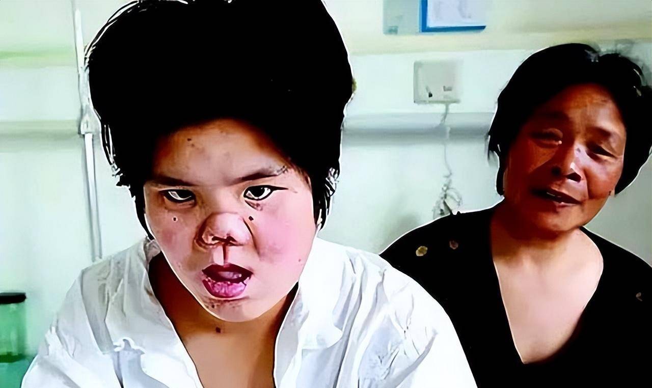 1988年,陕西农妇捡到坑面弃婴,整容变美后嫁给聋哑哥哥报恩