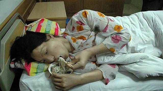 中国第一"女巨人",一顿吃2斤米饭,穿60码的鞋,遗体封存完整
