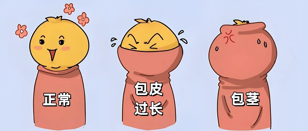 不得不说的秘密,包皮垢的科学认识_丁丁_男性_治疗