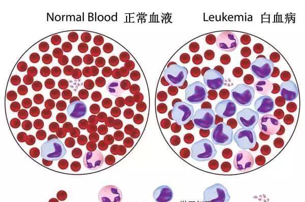 最美医生王振义:研制白血病"特效药"却不申专利,定价每盒13元